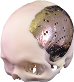 3D-Additive-manufacturing-skull